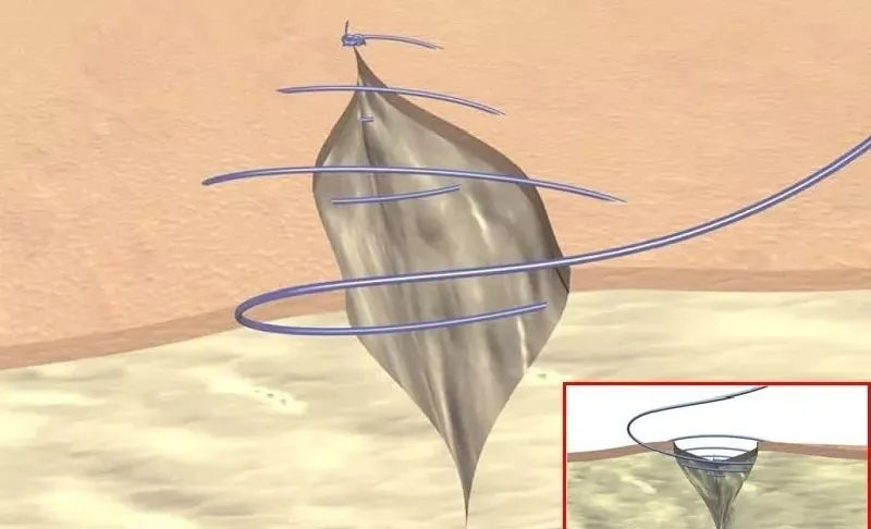 看圖區(qū)分外科縫線，學習縫合小秘訣